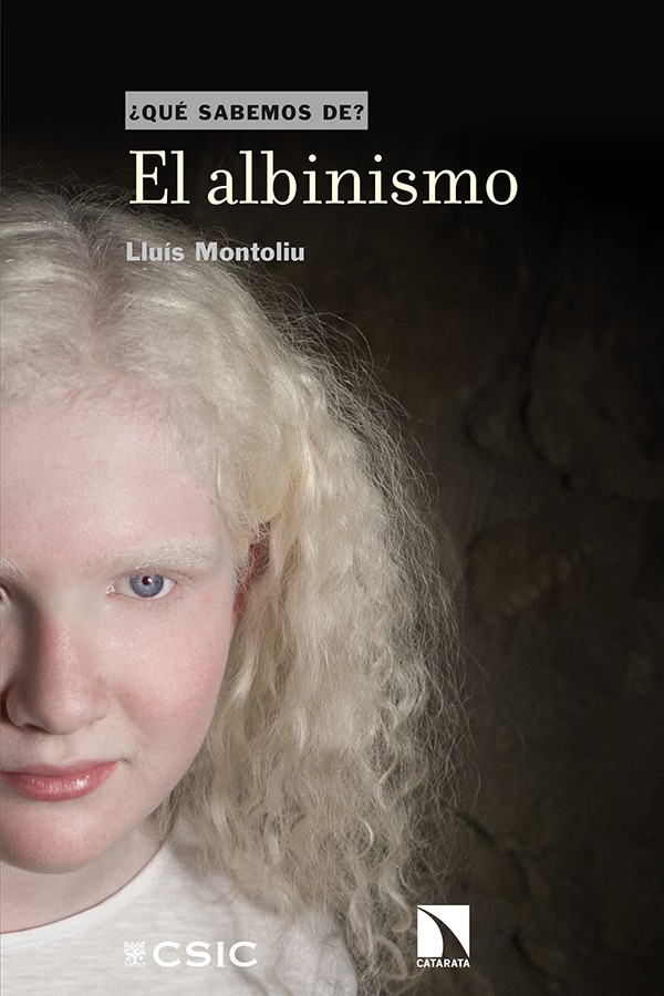 El albinismo